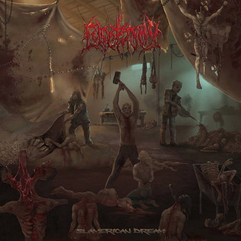 Lypektomy - Slamerican Dream