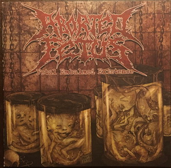 Aborted Fetus - Fetal Embalmed Existence